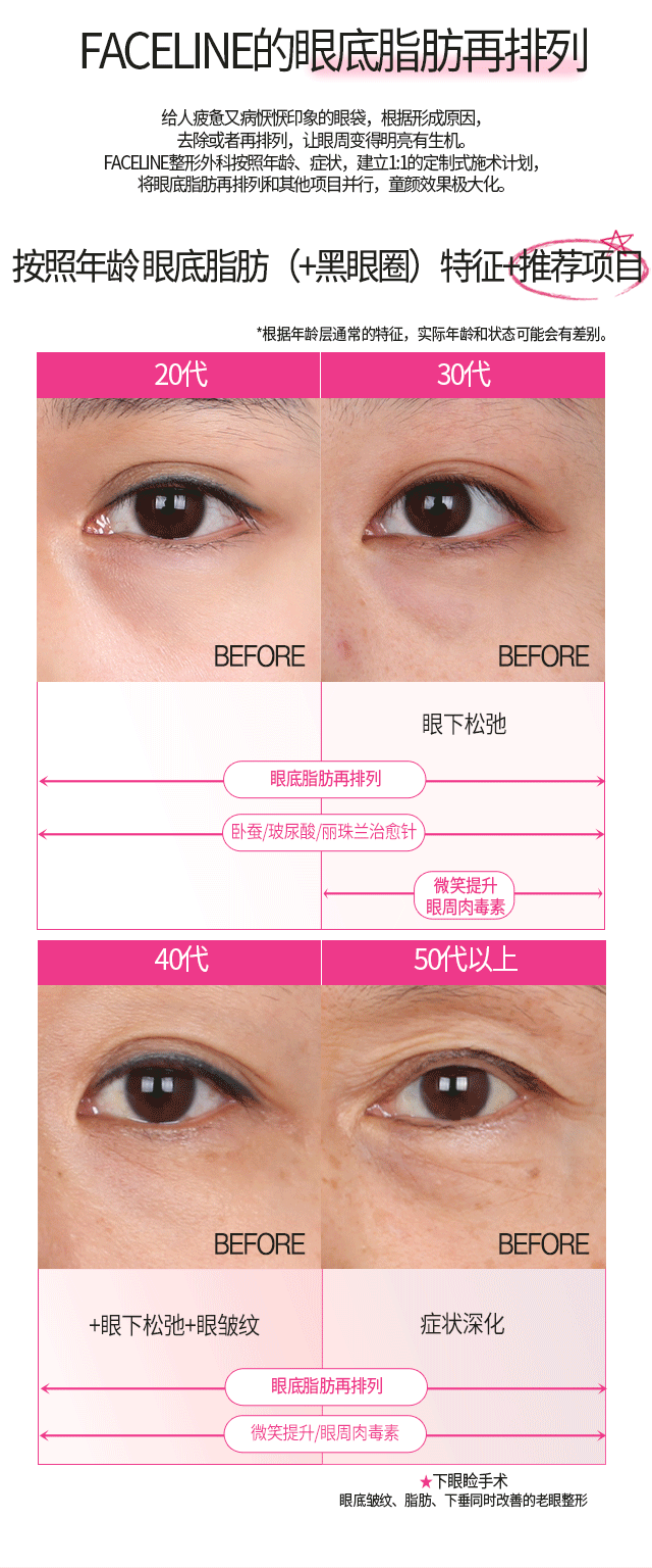 faceline 按照年龄 眼底脂肪（+黑眼圈）特征+推荐项目