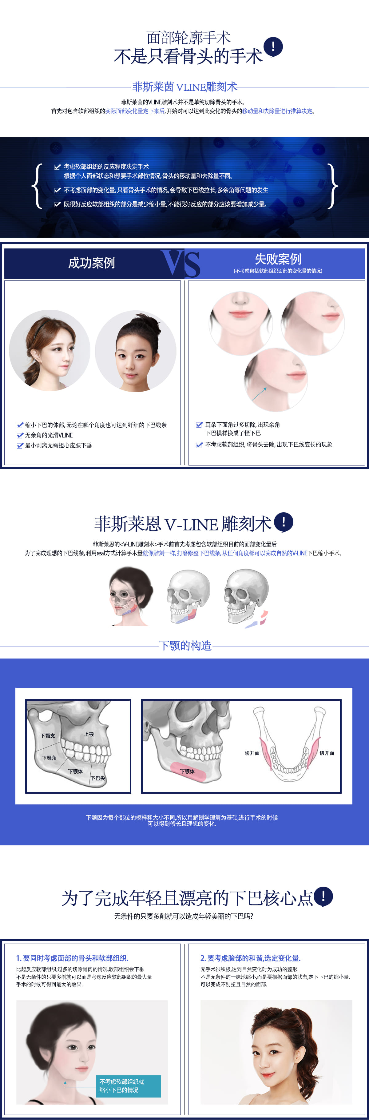 无捆绑双鄂手术 – id整形医院