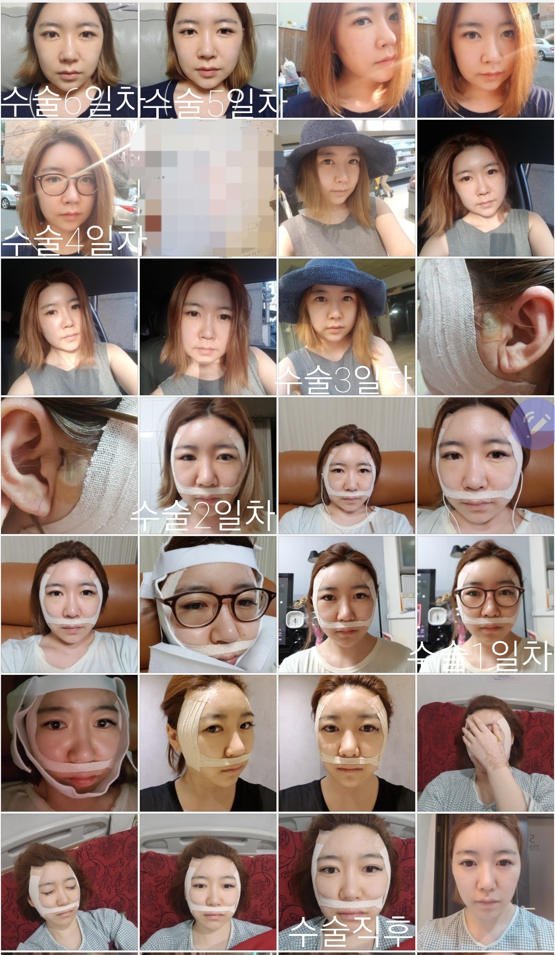 韩国faceline菲斯莱茵整形医院中国官网-韩国双鄂手术，面部轮廓整形，面部轮廓修复，面部轮廓医院